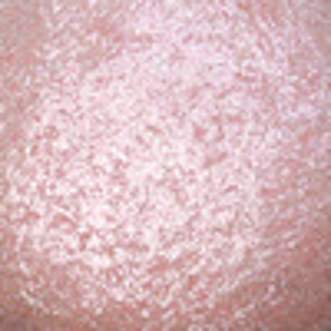 Dermacol Fémes szemhéjfesték Bonbon (Wet & Dry Metallic Eyeshadow) 6 g No.207